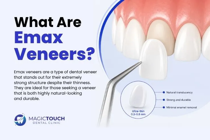 Emax laminate veneers in Antalya