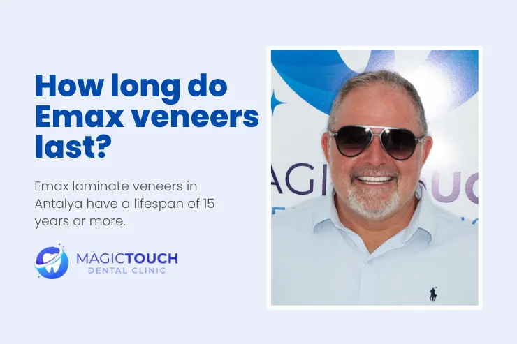 How long do Emax veneers last?