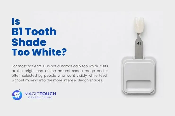 Is B1 tooth shade too white?