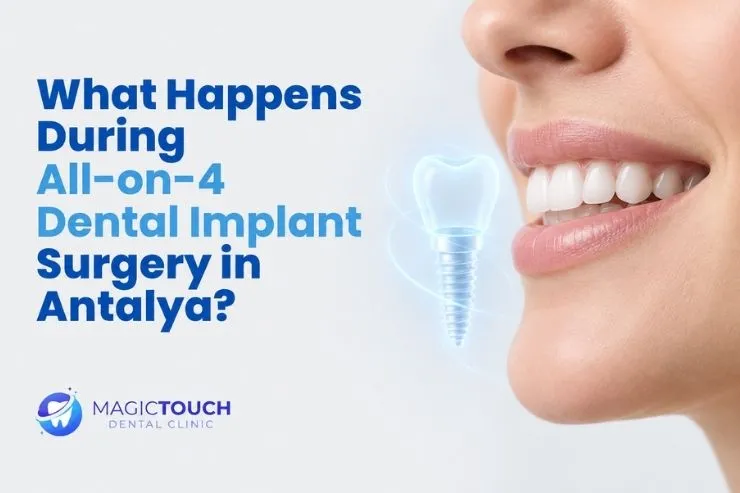 What happens during All on 4 dental implant surgery in Antalya?