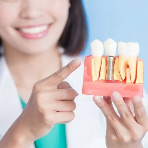 dental implant 7 Diş İmplantı