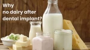 Why no dairy after dental implant?